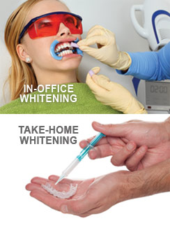 teeth-whitening-options